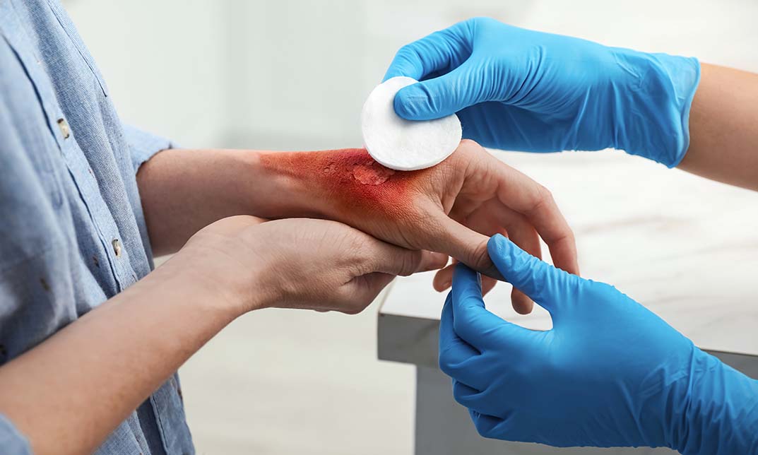 Wound Care & Tissue Viability