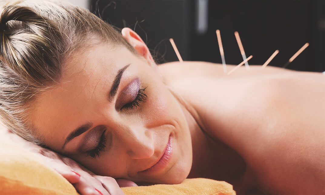 Certificate in Acupuncture