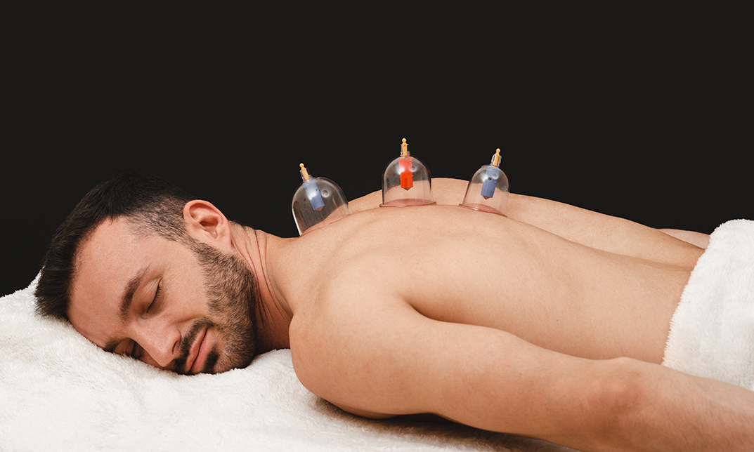 Professional Cupping Therapy