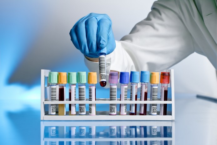 Understanding Blood Results 