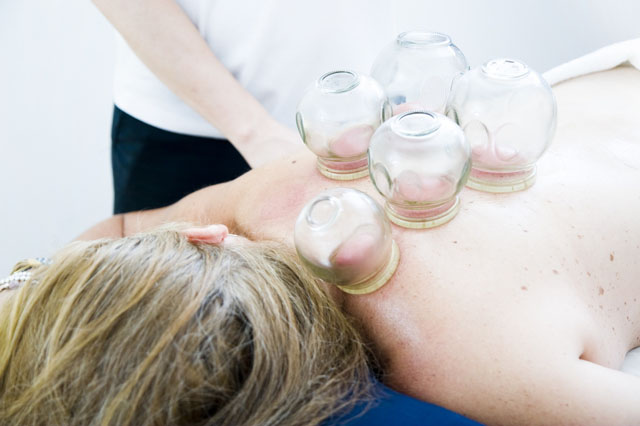 Cupping Therapy Course