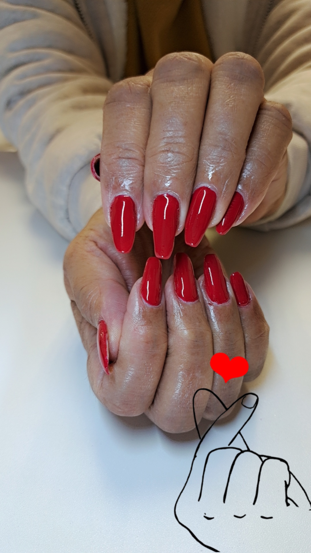 Gel application 