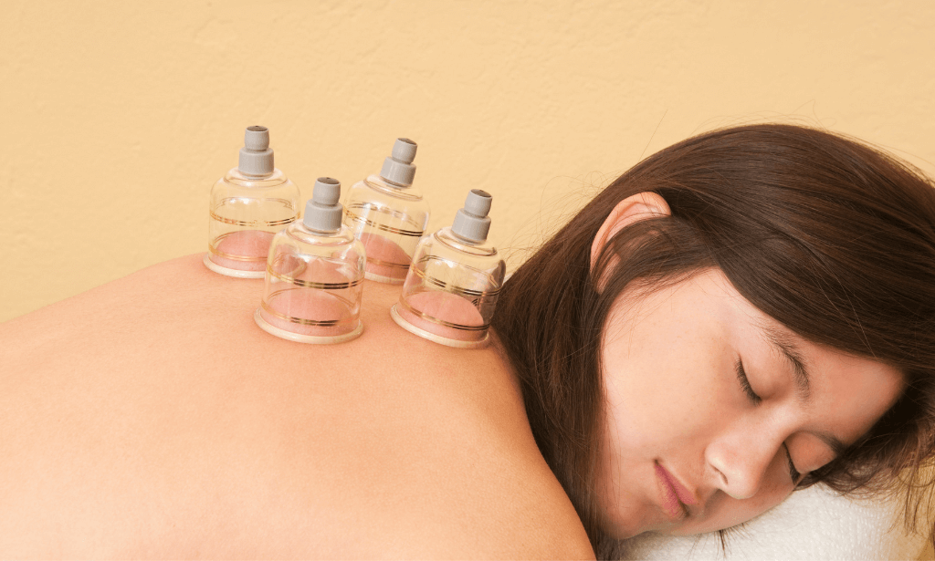 Clinical Cupping Therapy