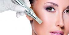 Level 4 Skin Needling (microneedling)