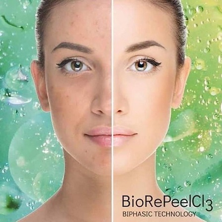 Microneedling & BioRePeel Diploma