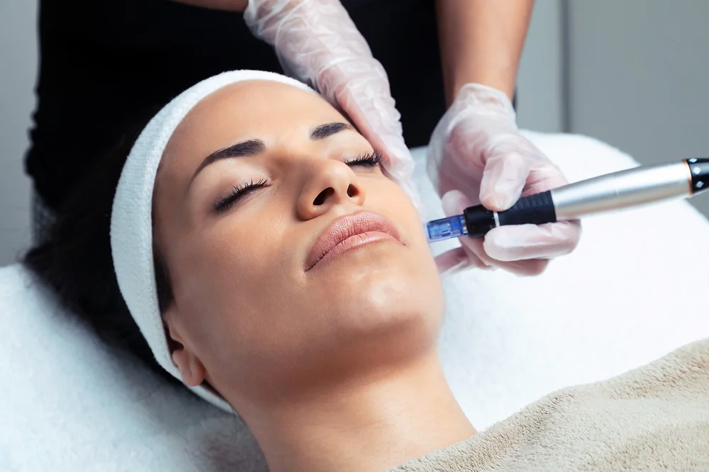 Online Microneedling Course