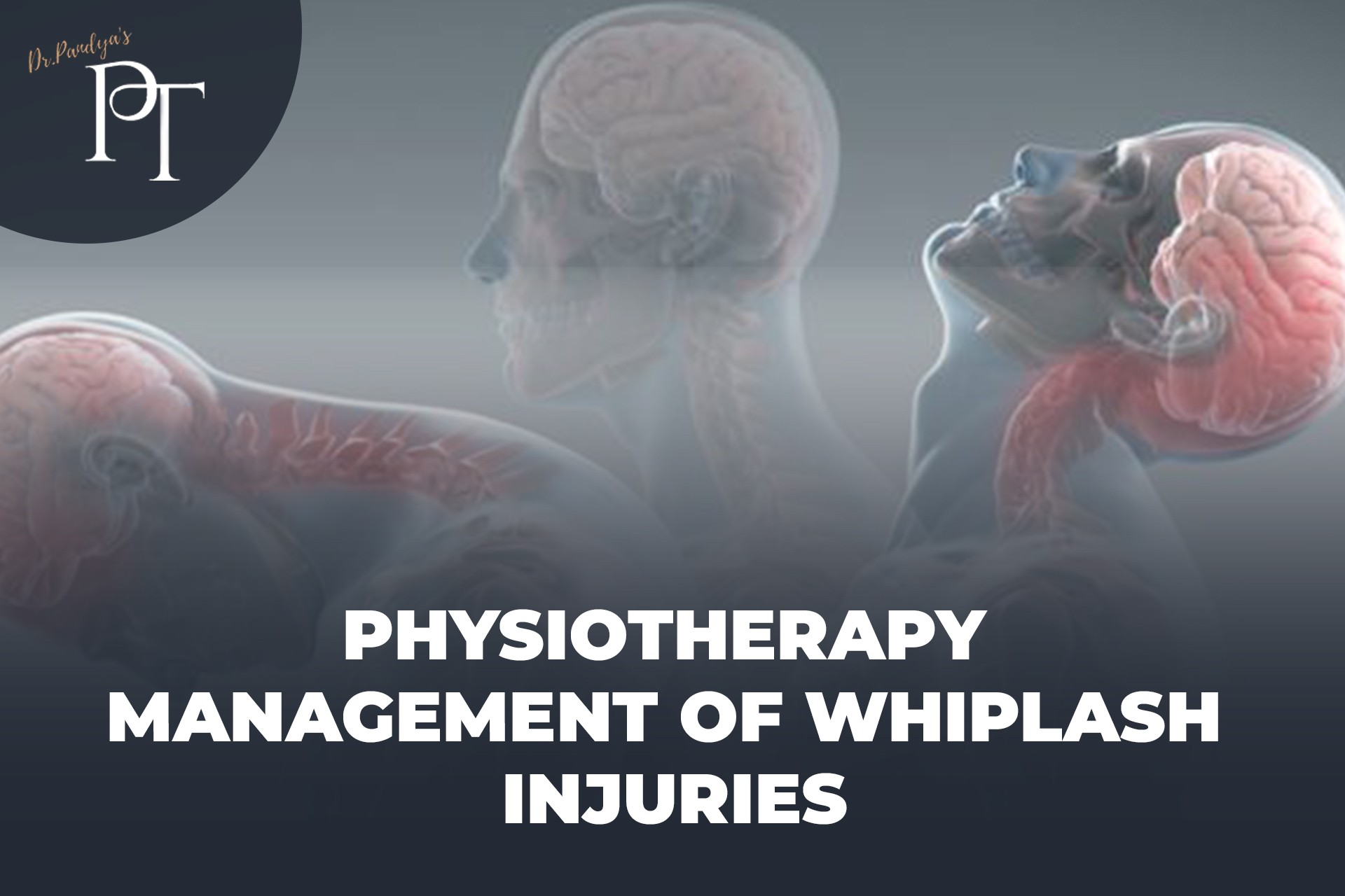 Physiotherapy management of Whiplash Injuries