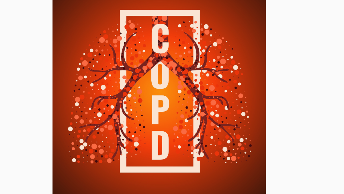 COPD Update