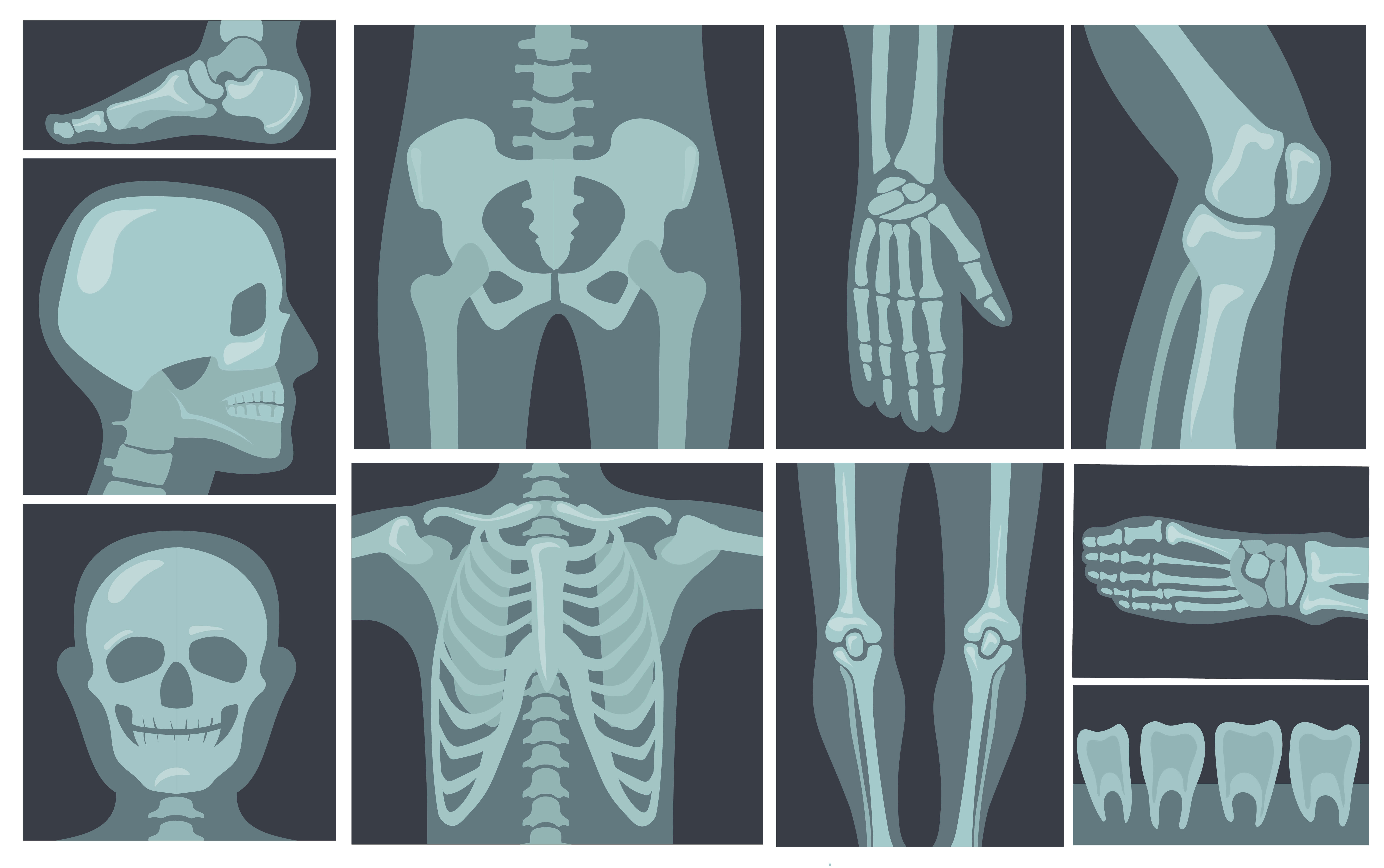 Radiography