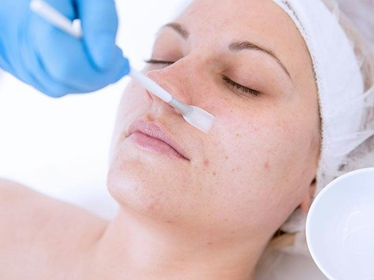 VTCT Level 4 Chemical Skin Peel Training