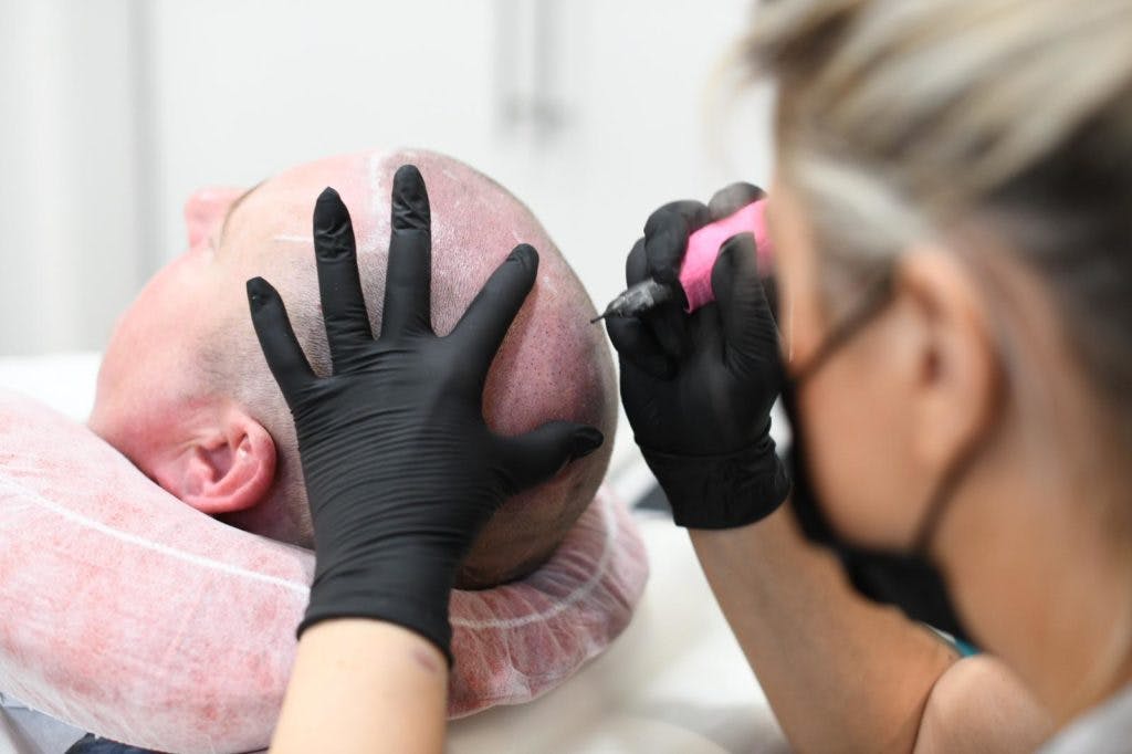 Scalp Micropigmentation Training Course