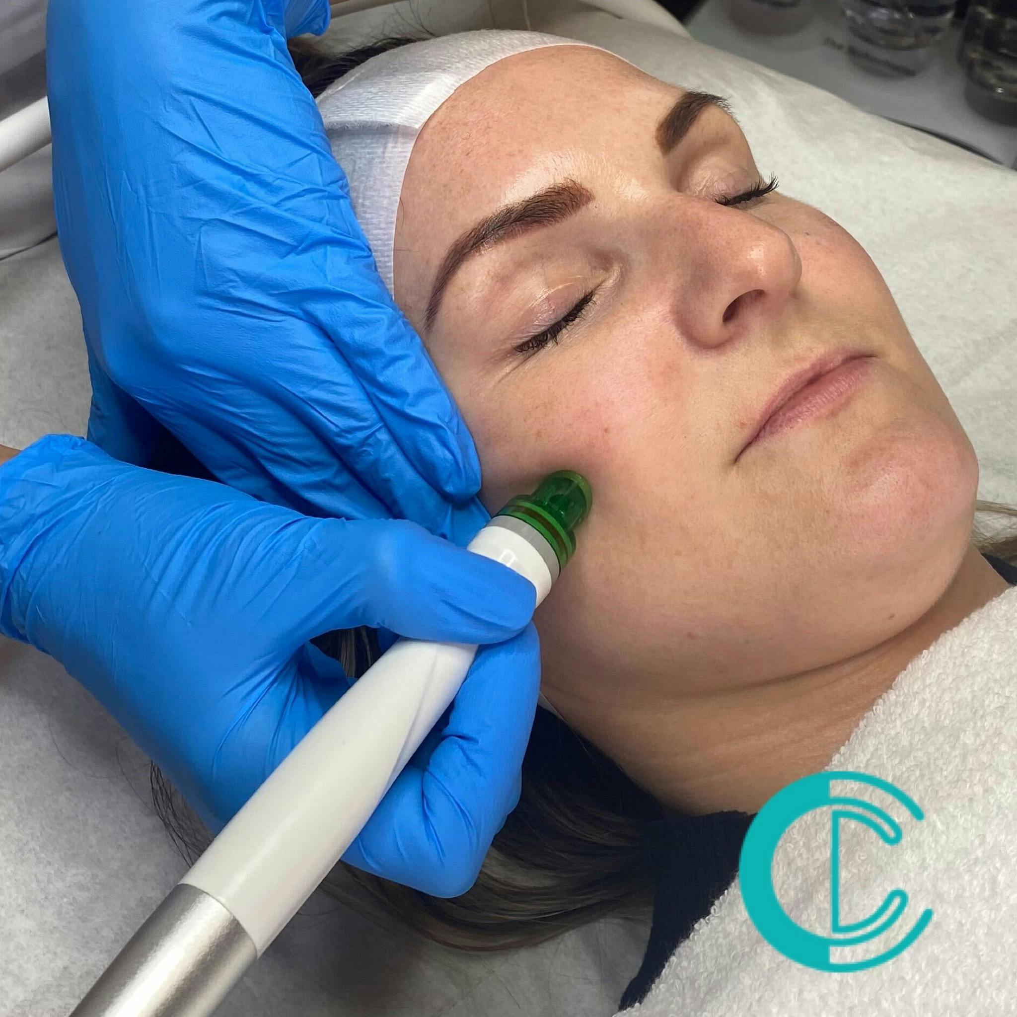 Hydra Dermabrasion Facials Training Course