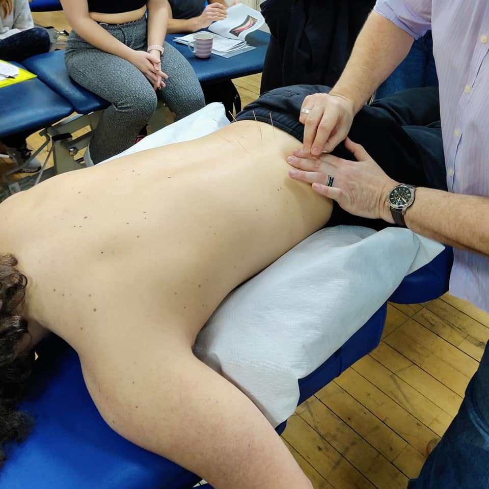 Advance Dry Needling Course (London, England) May 2025