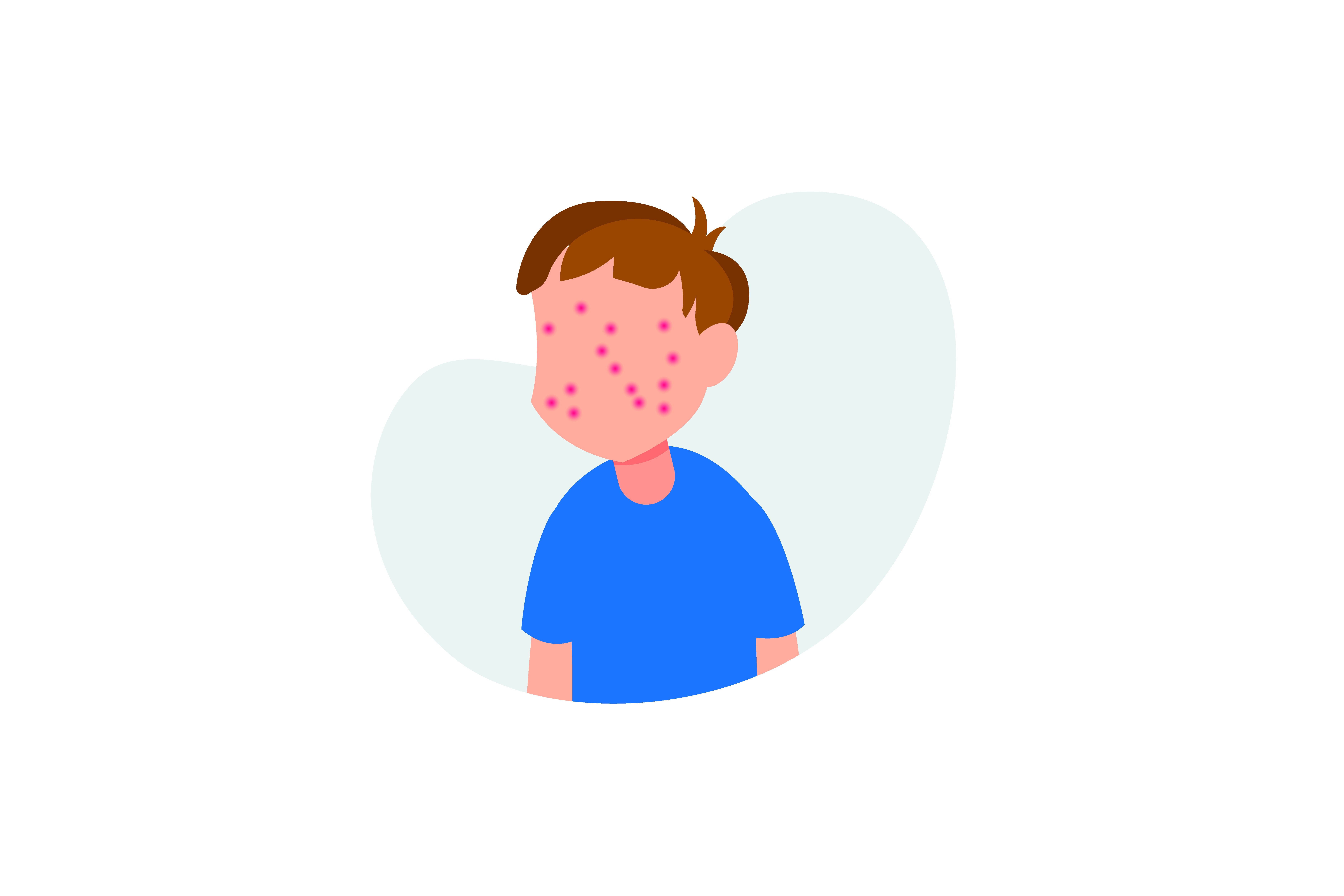 Management of Anaphylaxis | RQF level 3