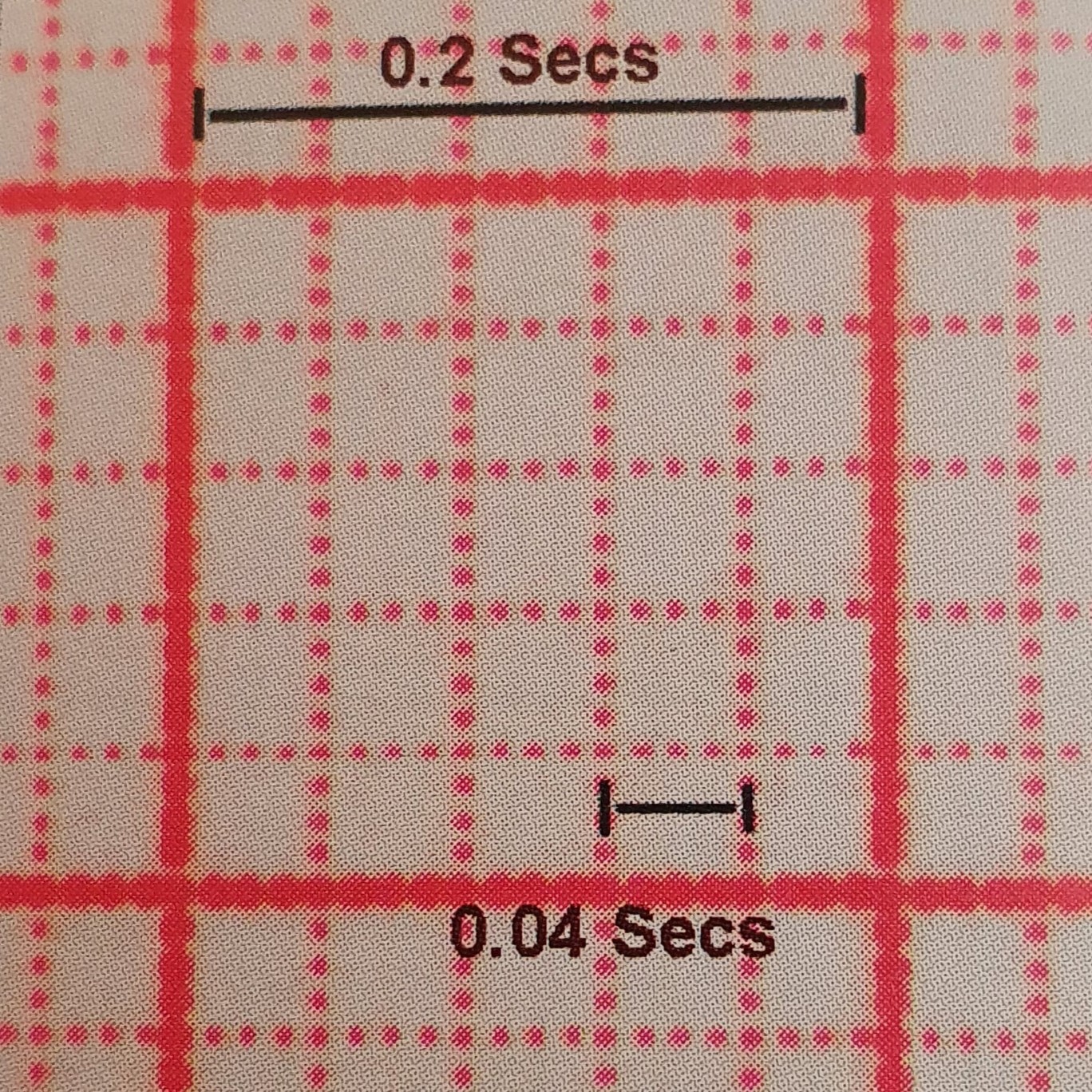 Basic ECG Interpretation