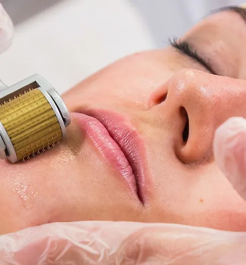 PRP - Collagen Induction Therapy Course (GPT701)