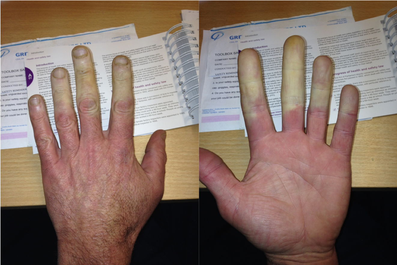 Hand Arm Vibration Management Essentials - HAV ME